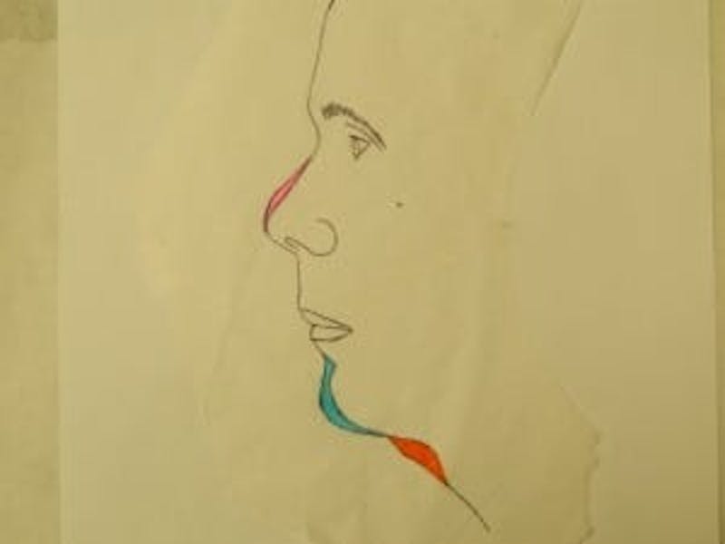 Facelift Before & After Gallery - Patient 133066485 - Image 5
