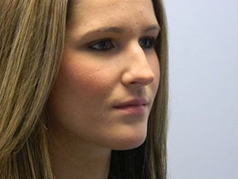 Non-Surgical Rhinoplasty and Injectable Fillers Before & After Gallery - Patient 133066531 - Image 3