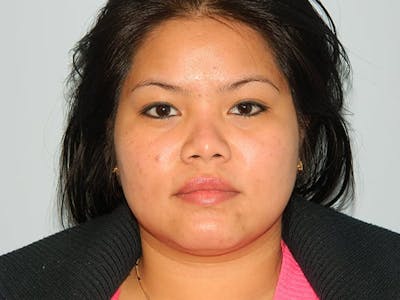 Non-Surgical Rhinoplasty and Injectable Fillers Before & After Gallery - Patient 133066540 - Image 1