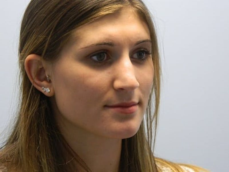 Rhinoplasty Before & After Gallery - Patient 133066581 - Image 3