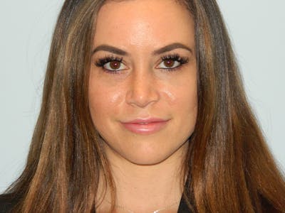 Rhinoplasty Before & After Gallery - Patient 133066653 - Image 2