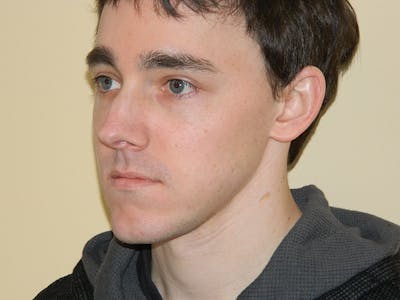 Rhinoplasty Before & After Gallery - Patient 133066667 - Image 1