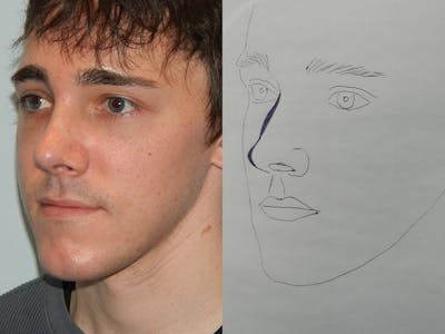 Rhinoplasty Before & After Gallery - Patient 133066667 - Image 2