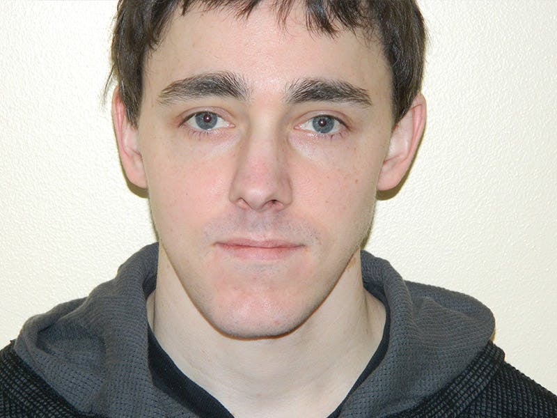 Rhinoplasty Before & After Gallery - Patient 133066667 - Image 5