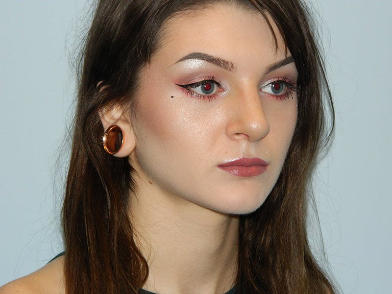 Rhinoplasty Before & After Gallery - Patient 133066673 - Image 4