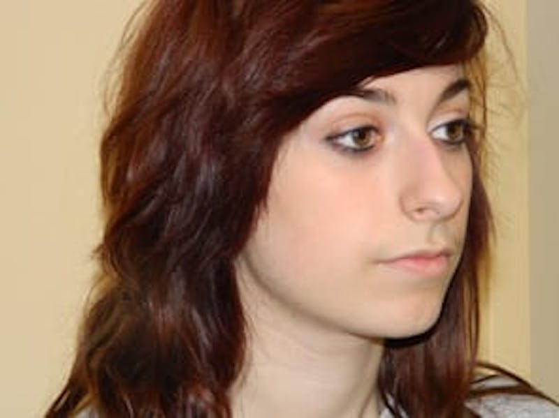 Rhinoplasty Before & After Gallery - Patient 133066684 - Image 5
