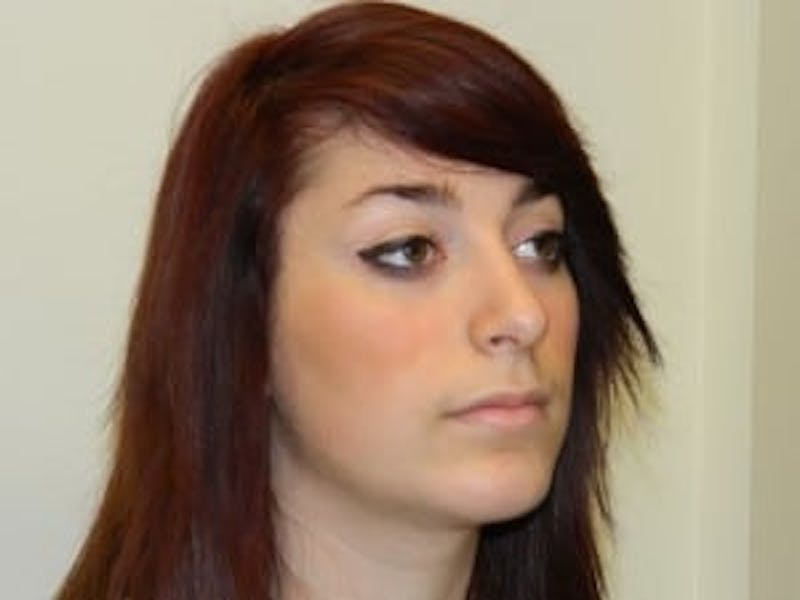 Rhinoplasty Before & After Gallery - Patient 133066684 - Image 6
