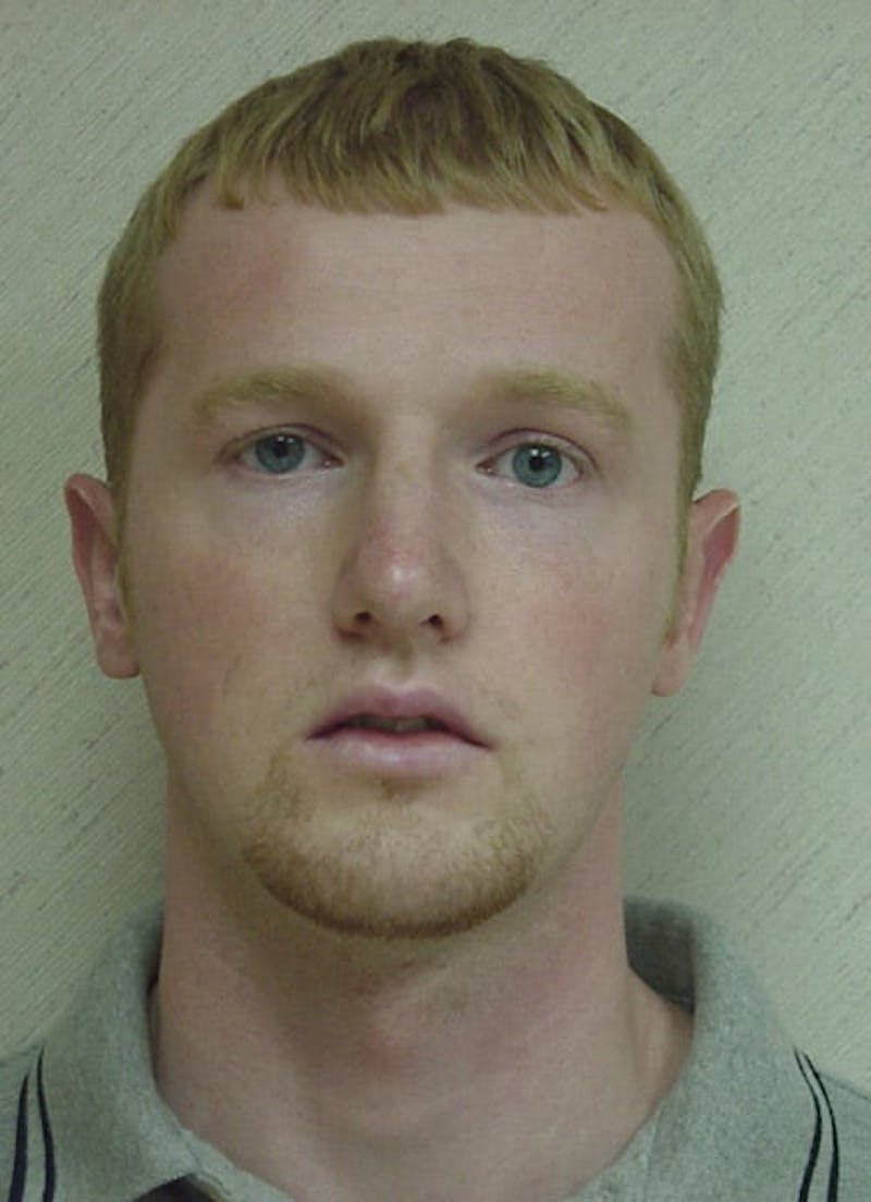 Rhinoplasty Before & After Gallery - Patient 133066698 - Image 8