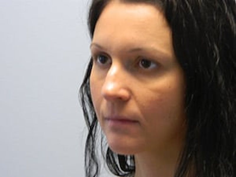 Rhinoplasty Before & After Gallery - Patient 133066722 - Image 5