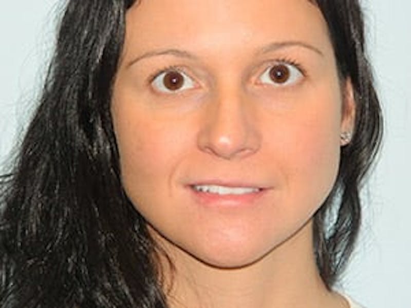 Rhinoplasty Before & After Gallery - Patient 133066722 - Image 7