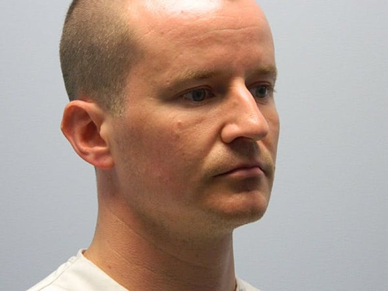 Rhinoplasty Before & After Gallery - Patient 133066725 - Image 5