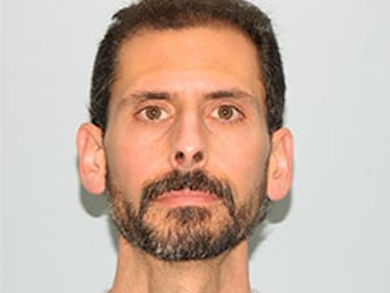 Rhinoplasty Before & After Gallery - Patient 133066746 - Image 7