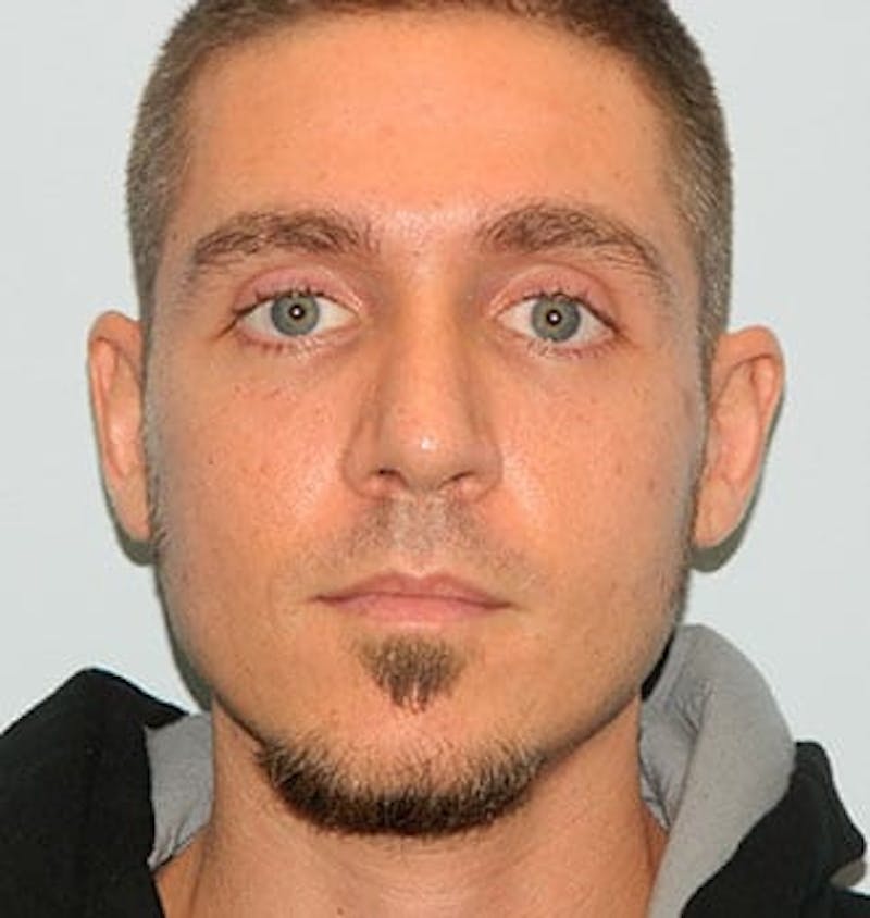 Rhinoplasty Before & After Gallery - Patient 133066775 - Image 4