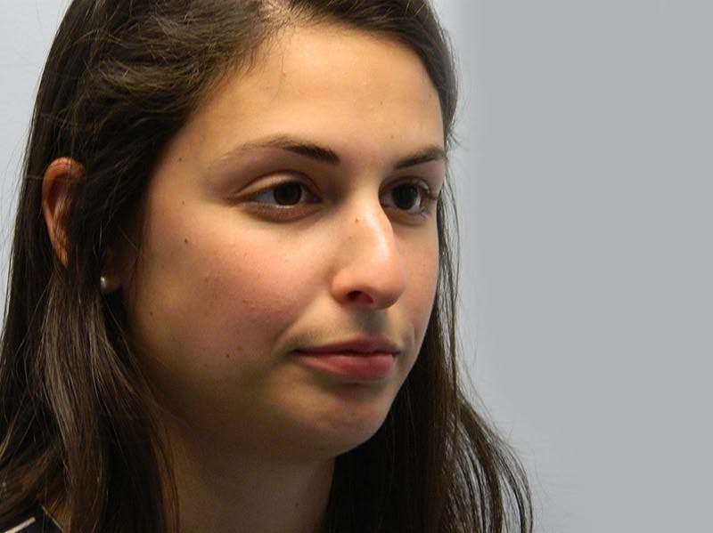 Rhinoplasty Before & After Gallery - Patient 133066789 - Image 5