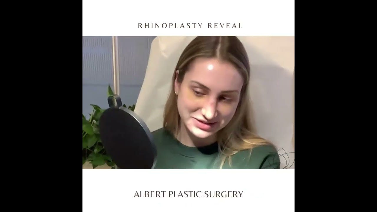 Rhinoplasty Reveal Thumbnail