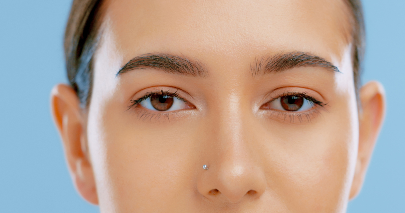 健康・医学 Closed rhinoplasty Just 1 Month after Closed Rhinoplasty. . I used closed