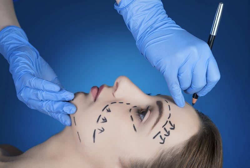 Woman preparing for a facelift