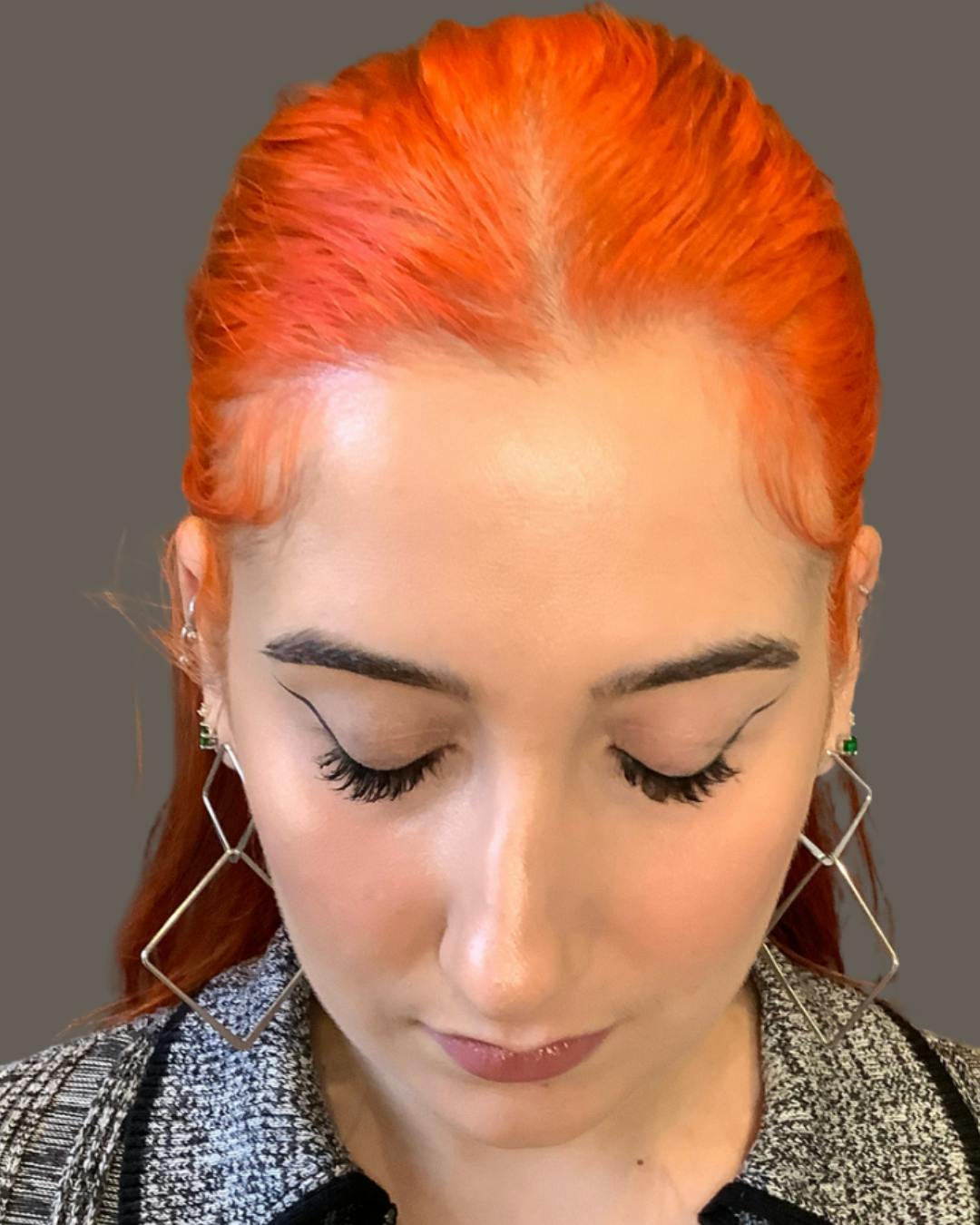 Rhinoplasty Before & After Gallery - Patient 143120 - Image 11