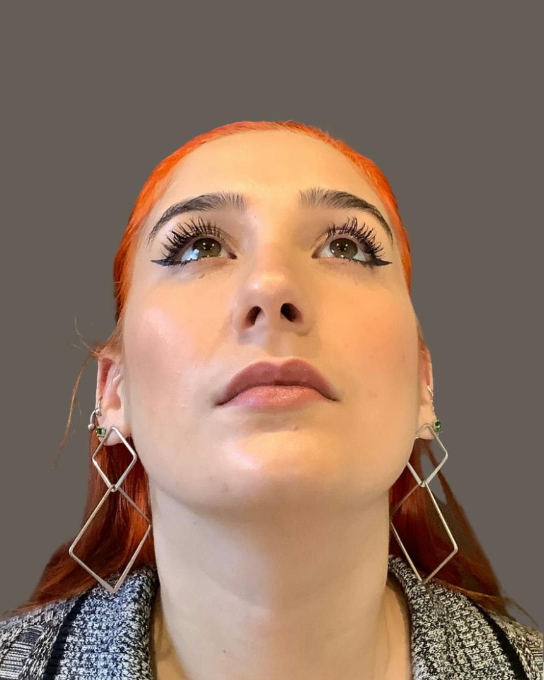 Rhinoplasty Before & After Gallery - Patient 143120 - Image 13