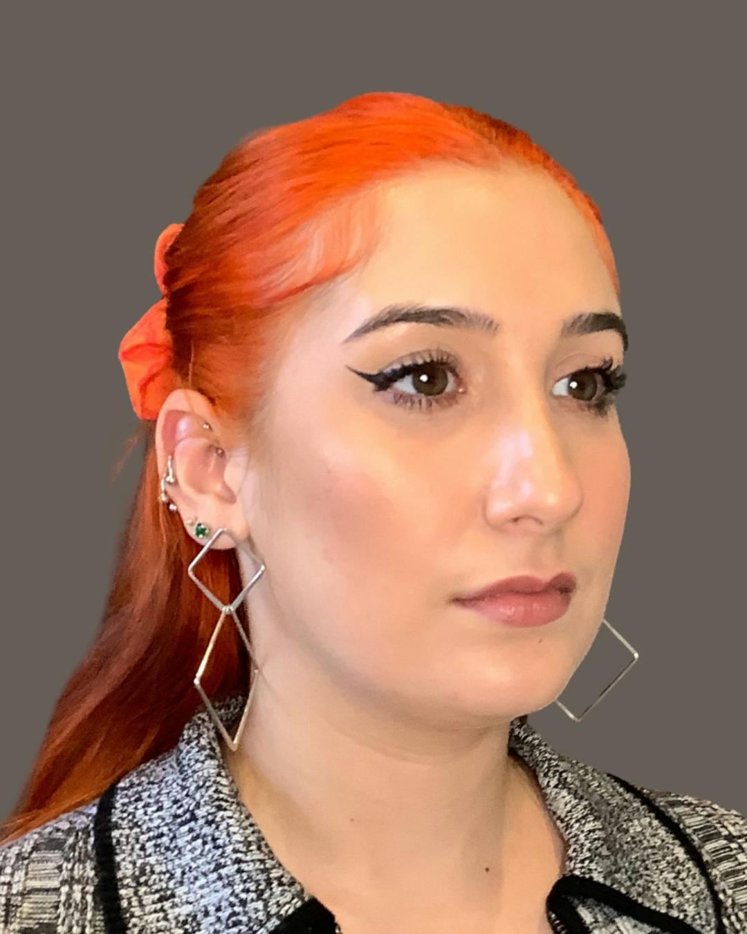 Rhinoplasty Before & After Gallery - Patient 143120 - Image 3