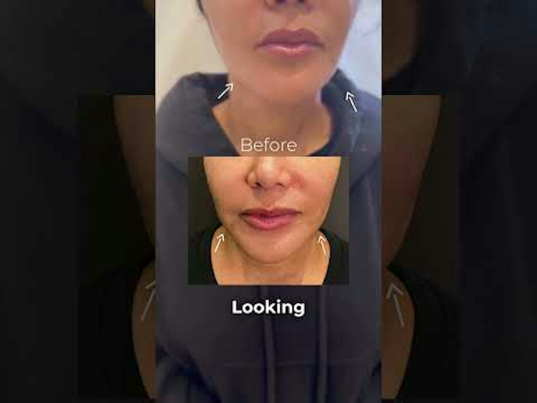 Albert Plastic Surgery