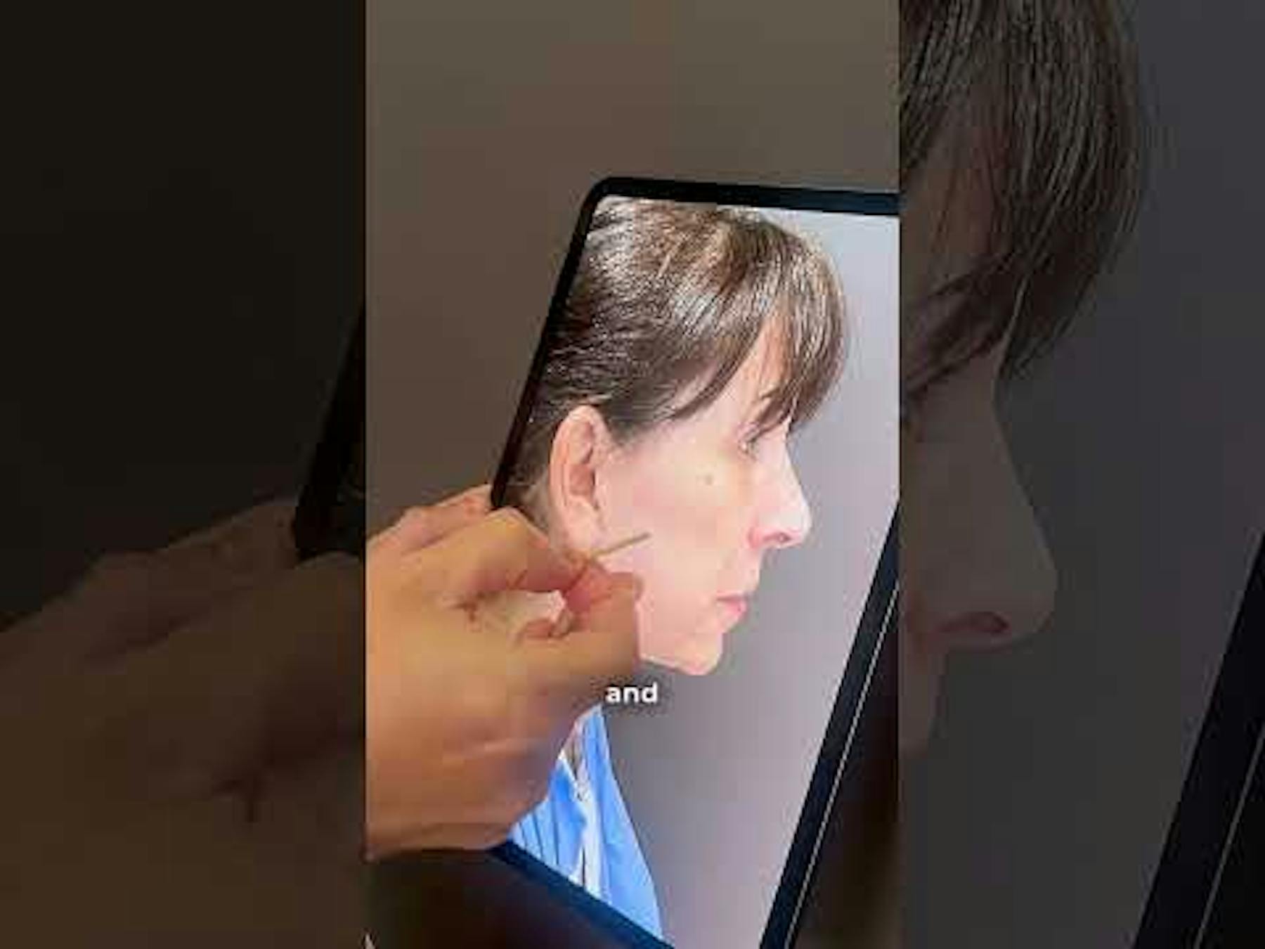 Albert Plastic Surgery