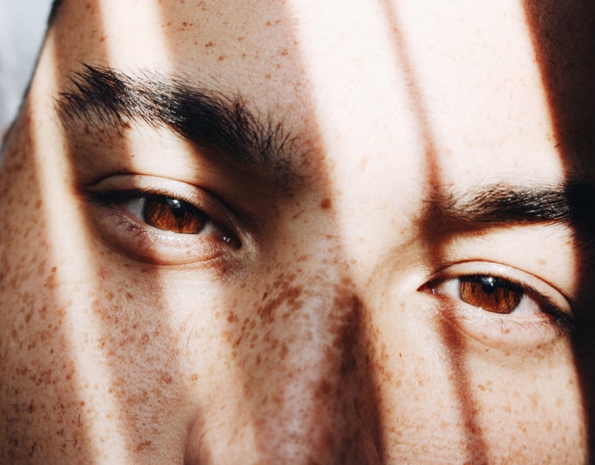 A close up of a man's face with freckles