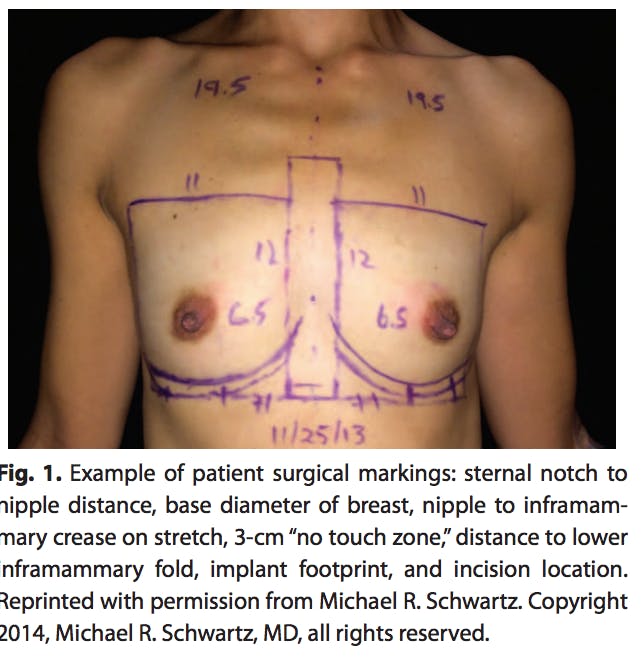 Shaped Implants  Breast Augmentation Surgery Los Angeles