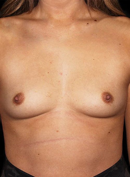 Description of image 3