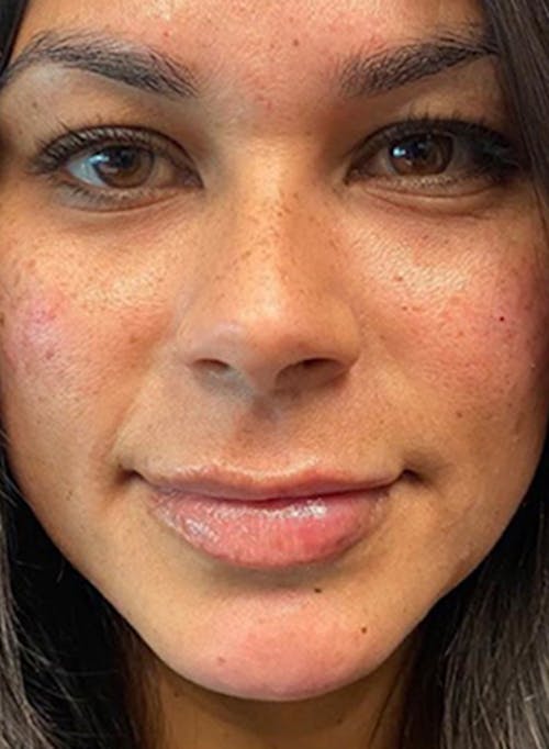 Description of image 3