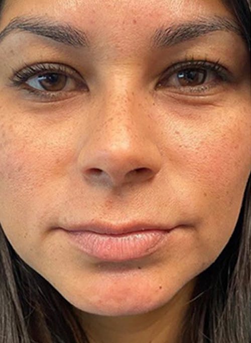 Description of image 3