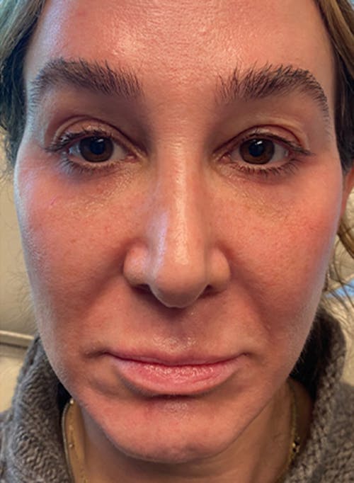 Description of image 3