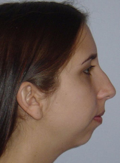 Description of image 3