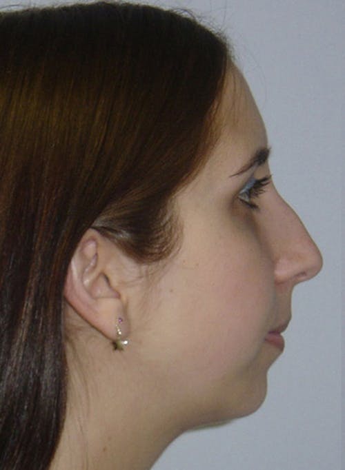 Description of image 3