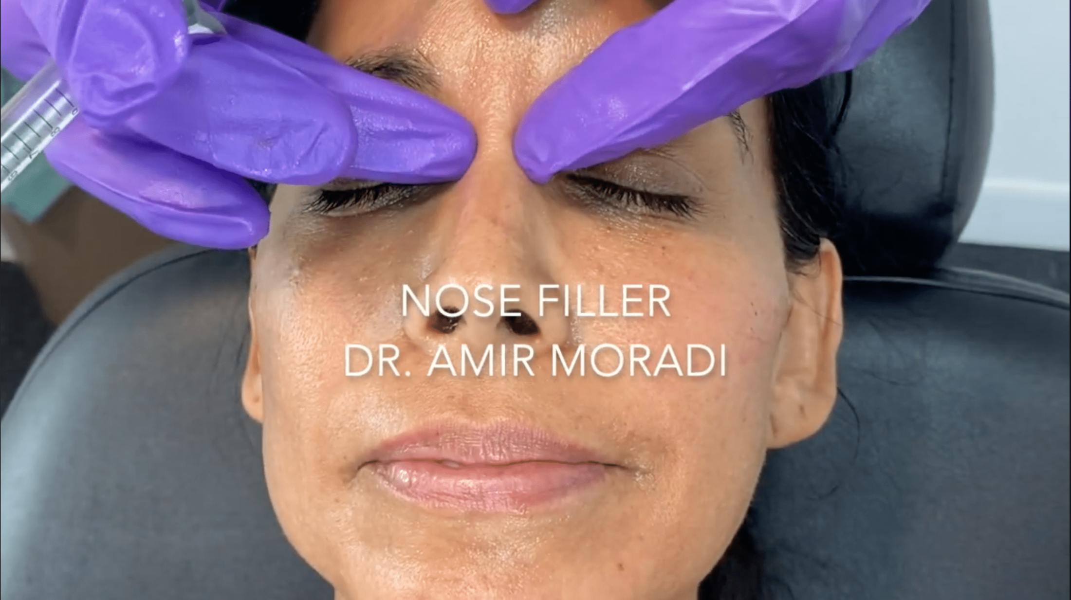 Nose filler video title card