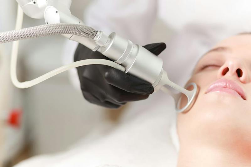 Woman receiving laser skin resurfacing