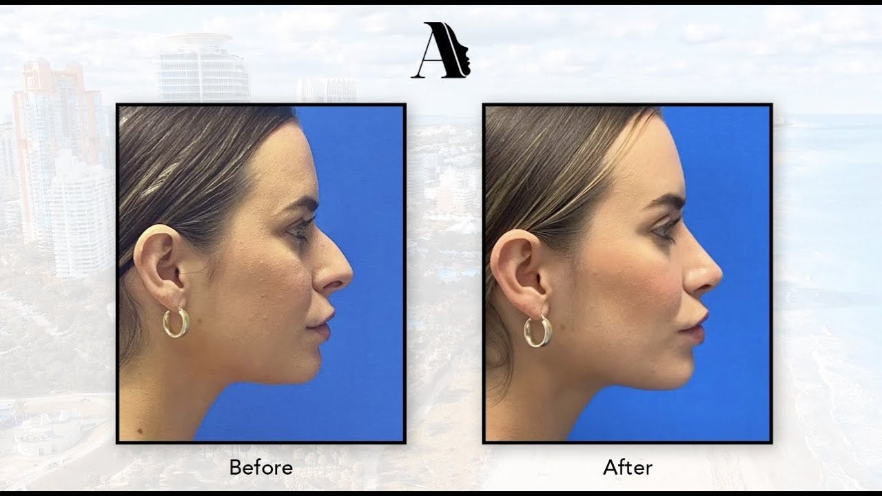 before and after image