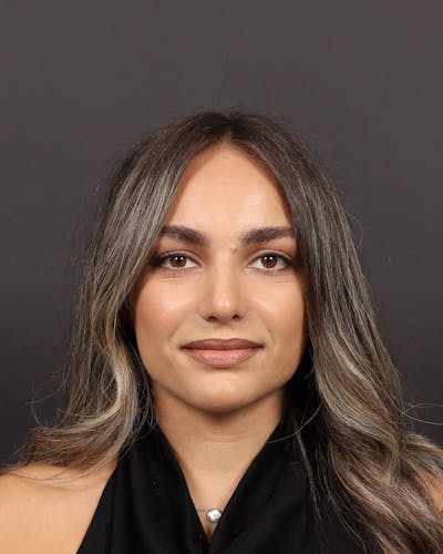 Primary Rhinoplasty Before & After Gallery - Patient 409431 - Image 2