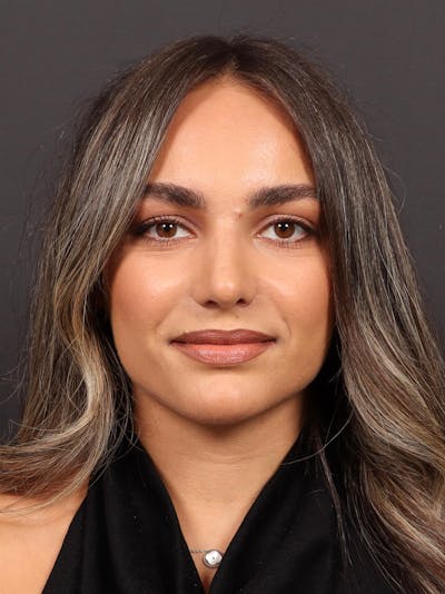 Primary Rhinoplasty Before & After Gallery - Patient 409431 - Image 2