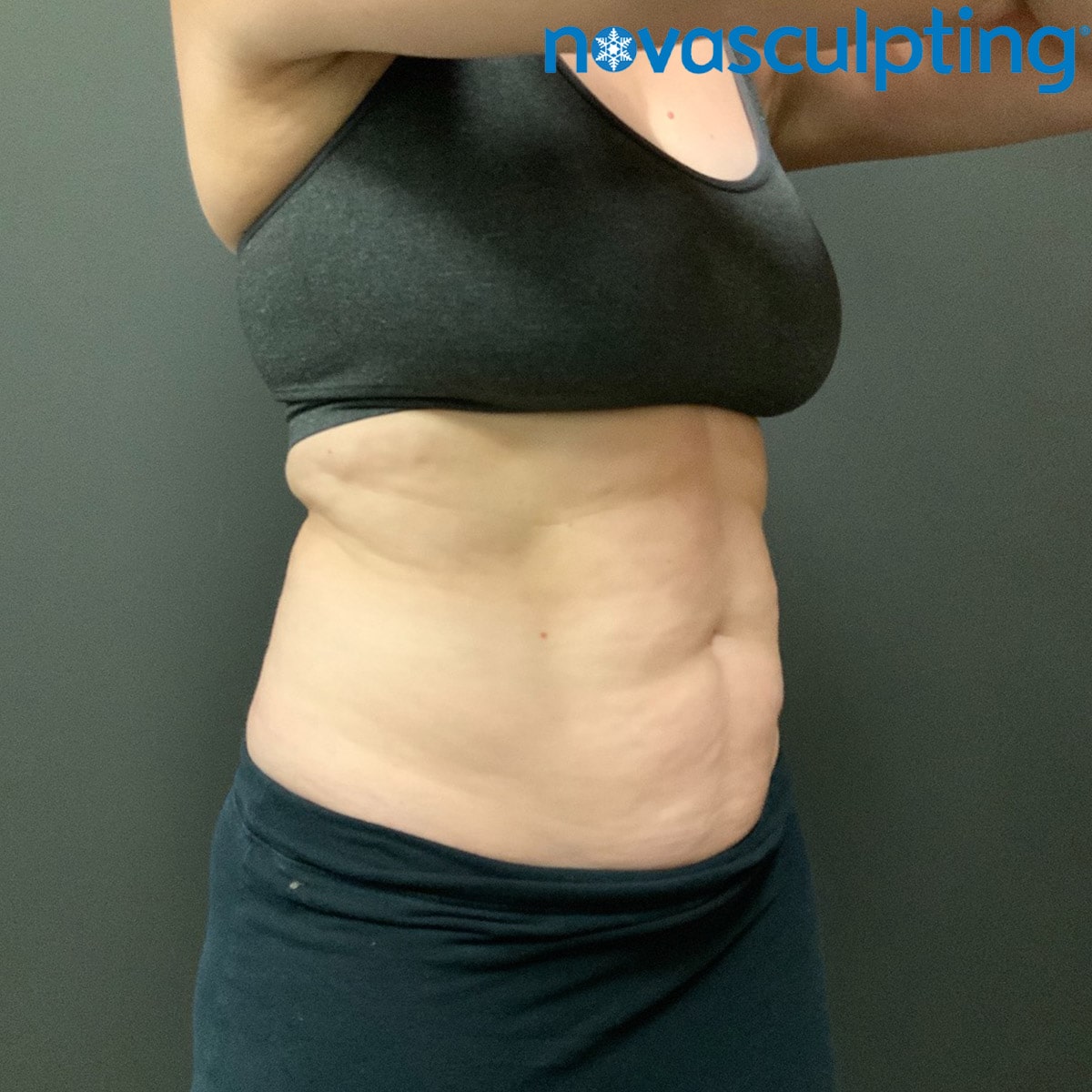 Abdomen Arlington