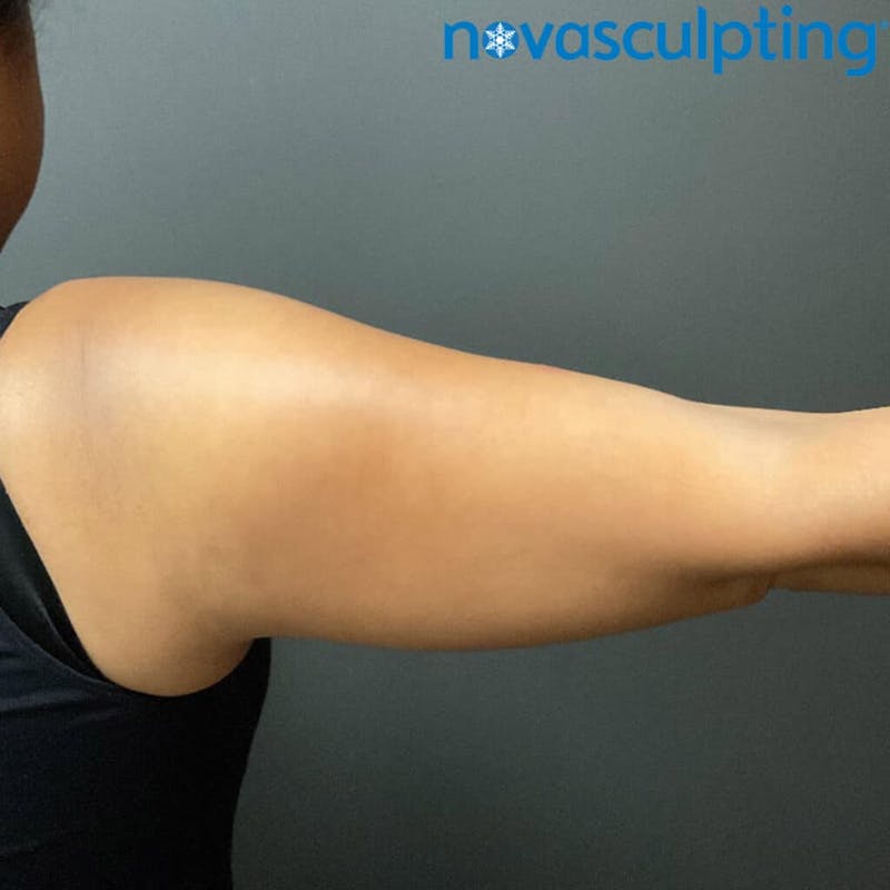 Arms