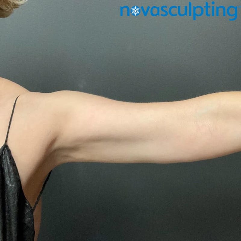 Arms