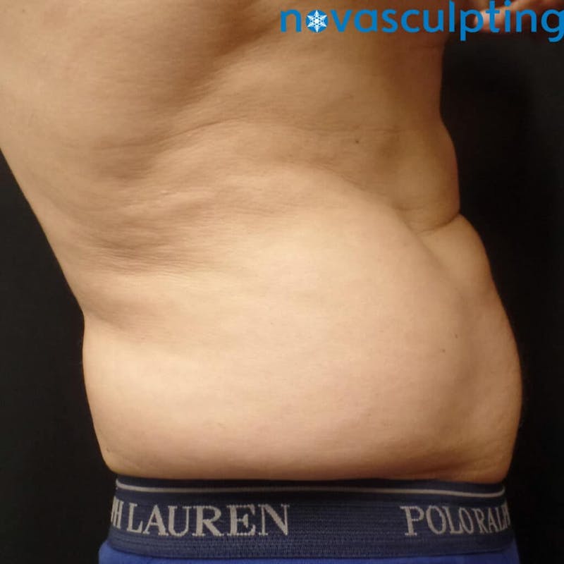 Love Handles