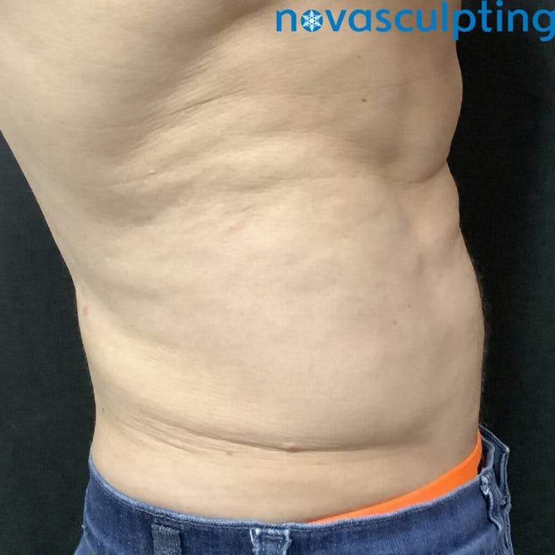 Love Handles
