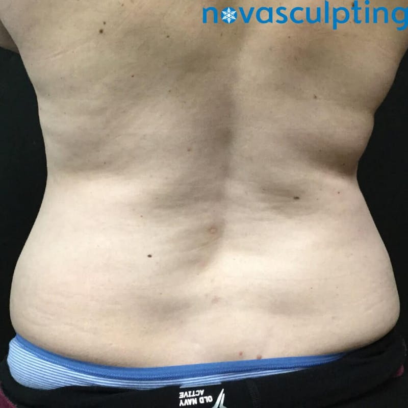 Love Handles