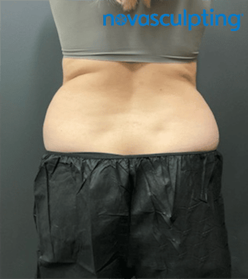 Bra Fat