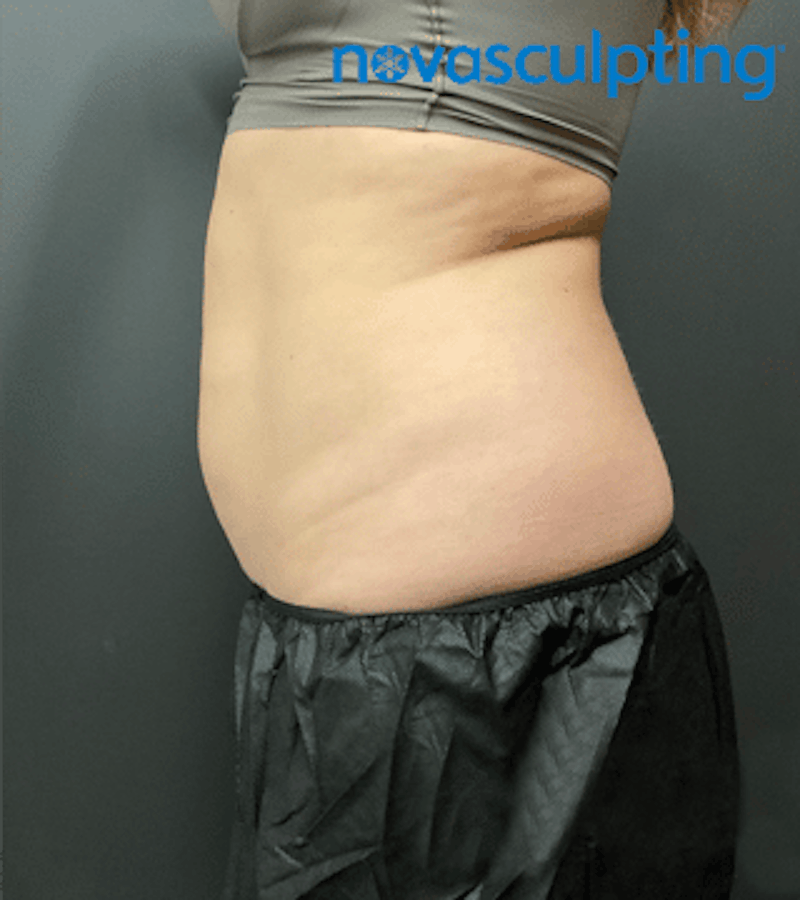 Bra Fat