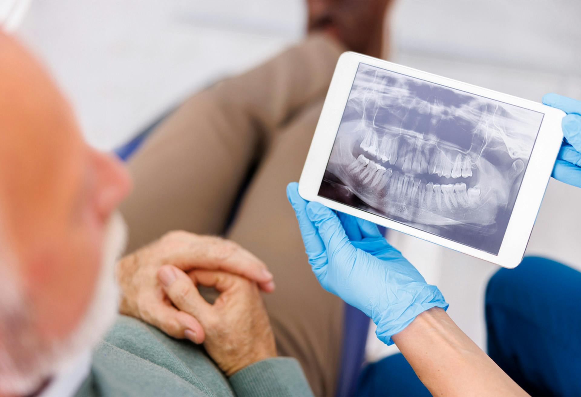 Man looking at an x-ray