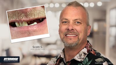 Smile Makeovers Before & After Gallery - Patient 93780861 - Image 1