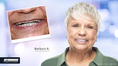 Smile Makeovers Before & After Gallery - Patient 93780859 - Image 1